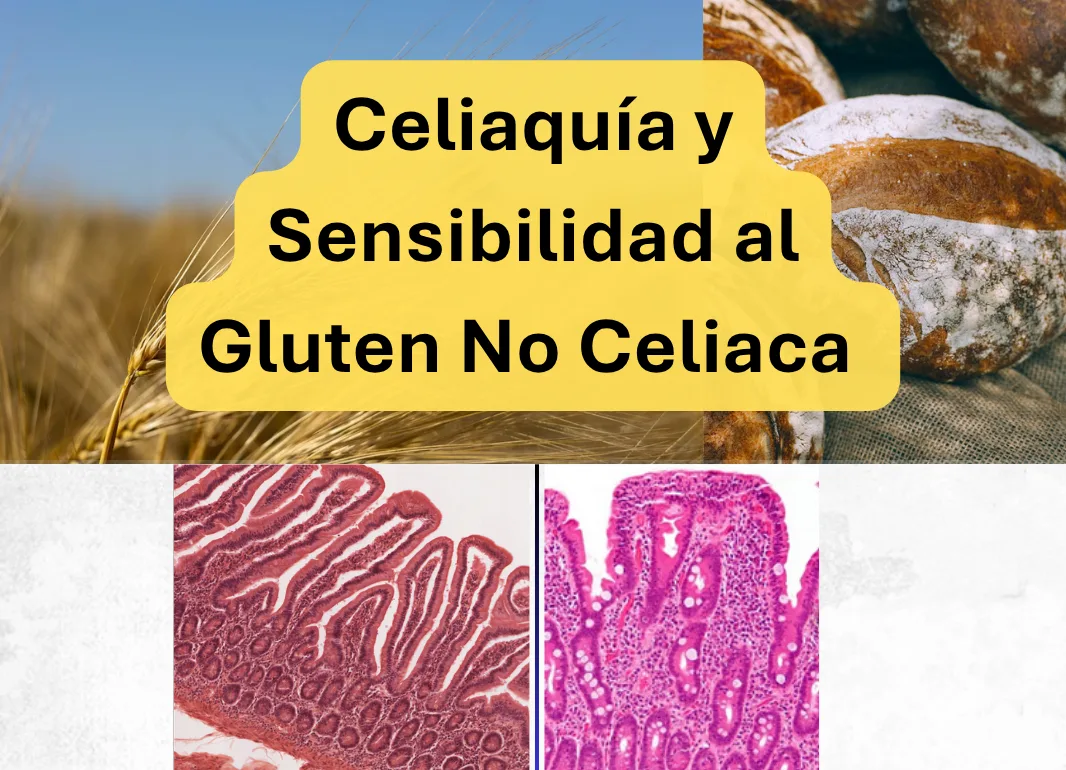 Dieta sin gluten para celíacos: guía completa para organizar tu alimentación y evitar riesgos.